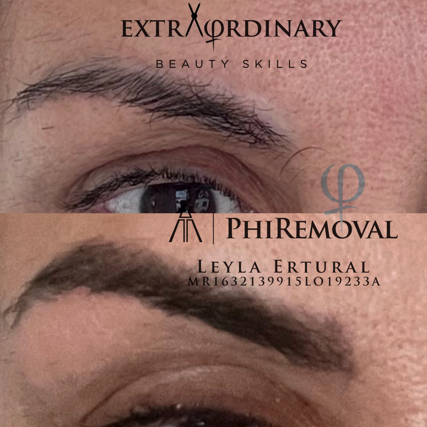 PMU-ENTFERNER PUREBEAU – Leyla Ertural