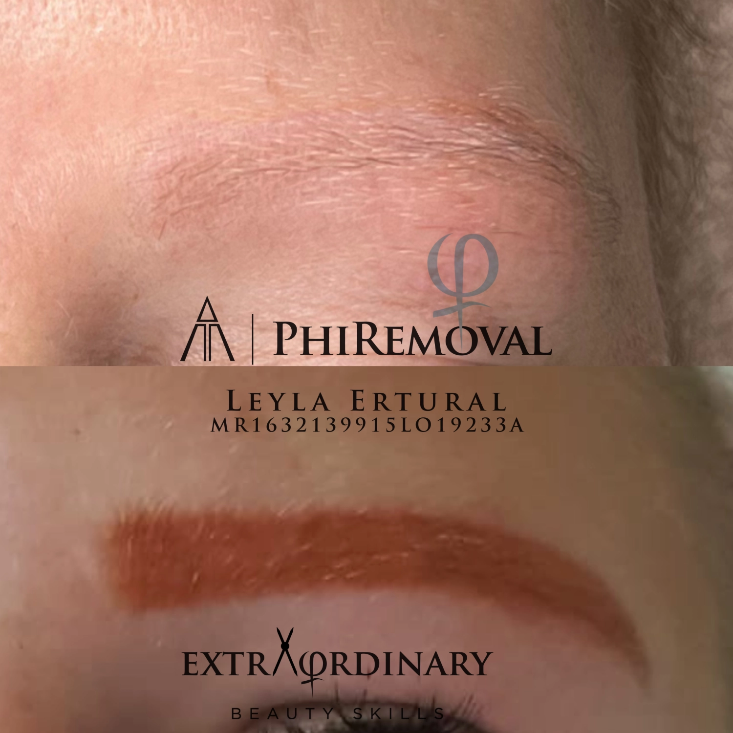 PMU-ENTFERNER PUREBEAU – Leyla Ertural