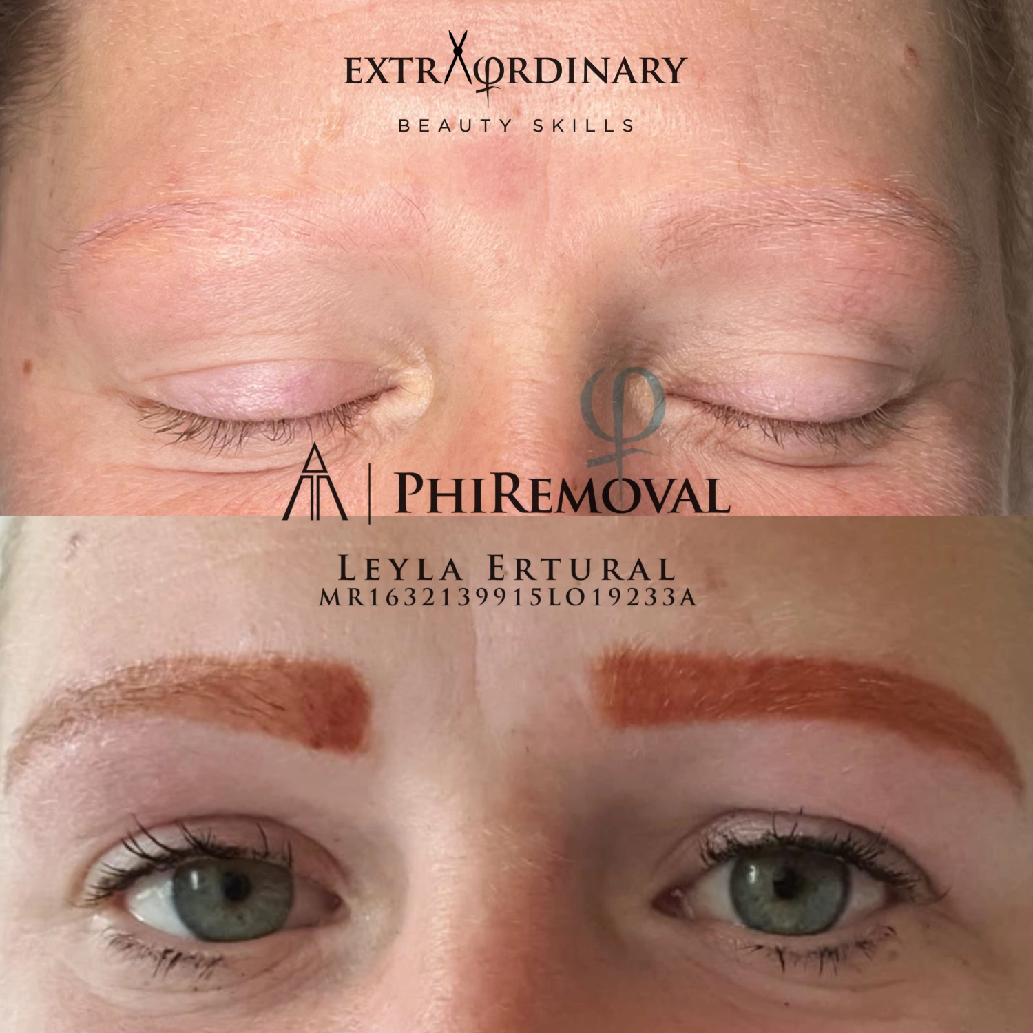 PMU-ENTFERNER PUREBEAU – Leyla Ertural