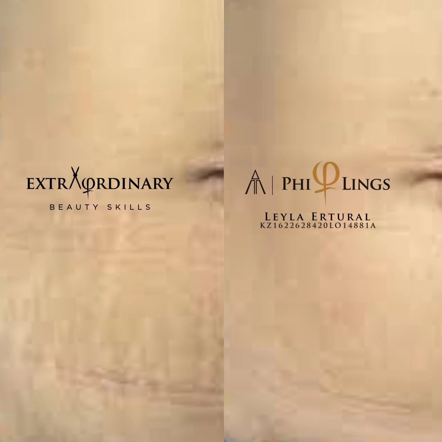 Vor und nach Radiofrequenz Needling – Leyla Ertural